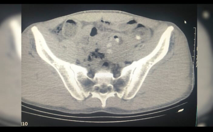 Midelerinde uyuşturucu ile yakalanan yabancı uyruklu 3 şüpheli tutuklandı