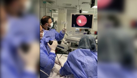 Hastanın akciğerine kaçan sarımsak operasyonla çıkarıldı