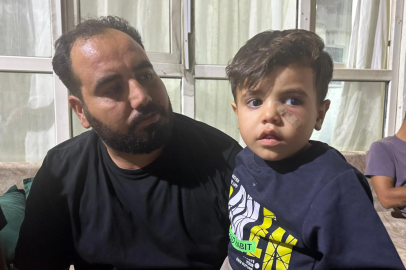 Yorgun mermi, 4 yaşındaki çocuğun gözünün altına isabet etti