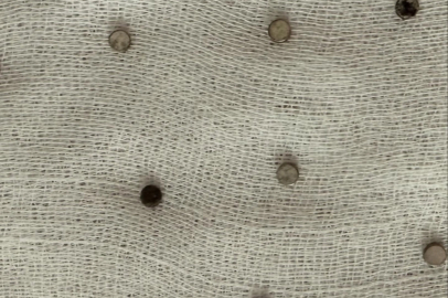 3 yaşındaki çocuğun yuttuğu 19 mıknatıs endoskopiyle çıkarıldı