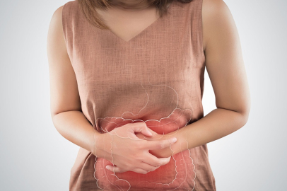 Kabızlığa Karşı Lif, Probiyotik, Kivi, Mineralli Sular ve Kuru Erik İle Doğal Destek