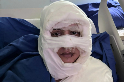 Kadıköy'de bir kadın, üzerine yanıcı madde dökülerek ateşe verildi