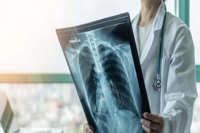 Prof. Dr. Şener'den 'süperenfeksiyon' uyarısı