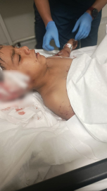 Okul çıkışı sokak köpeklerinin saldırdığı Davut, yaralandı