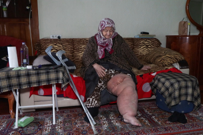 "Beni Kurtarın!" – 77 Yaşındaki Hava Teyze'nin Çaresiz Çığlığı