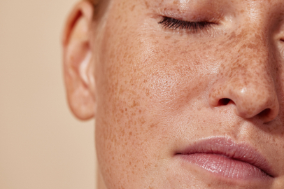 Leke tedavisinde en etkili yöntemler neler?