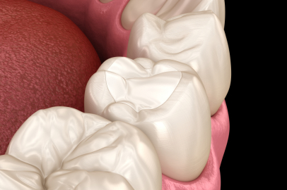 Dolgunun Ömrünü 2 Kat Uzatmak Mümkün mü? 4 Basit Kural