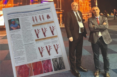 3 Bin 300 Hastada Uygulandı, Komplikasyonlar Azaldı