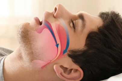 Horlama Masum Mu, Tehlikeli Mi? Uzmanlar Uyarıyor