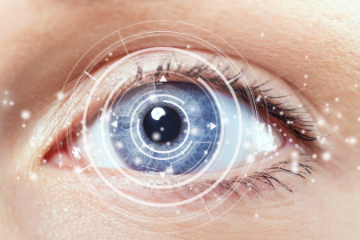 Katarakt Ameliyatında “Akıllı Mercek” Herkese Uygun mu?