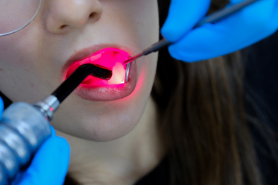 Türk Akademisyenin Lazerle Hızlı İyileşme Keşfi Literatürde