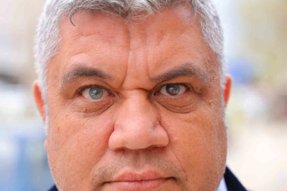 Kahramanmaraşlı Mehmet'in 3 Farklı Göz Rengi Görenleri Şaşırtıyor