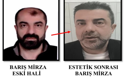 Cinayette azmettirmekten aranan şüpheli, ameliyatla yüzünü değiştirmiş