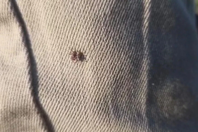 Keneye karşı uyarırken bile üzerinde kene gezdi

