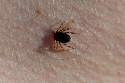 Doğu Karadeniz’de kene sezonu sakin geçiyor
