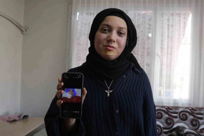 Kanseri yenen Buse’nin hayali kendisi gibi hastalara umut olmak
