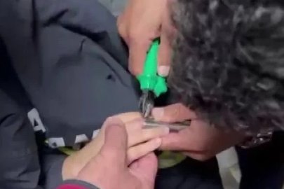 Parmağını boruya sıkıştıran küçük kızın yardımına itfaiye yetişti
