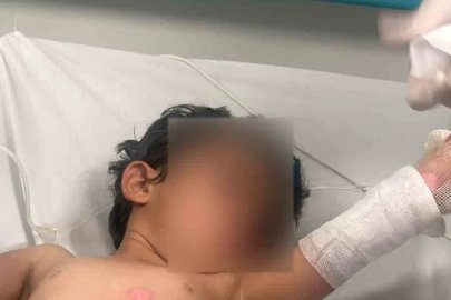 Şırnak’ta 3 yaşındaki kızın üzerine kaynar su döküldü
